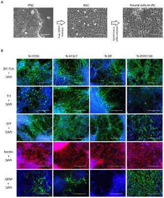 Different iPSC-derived neural stem cells shows various spectrums of spontaneous differentiation during long term cultivation